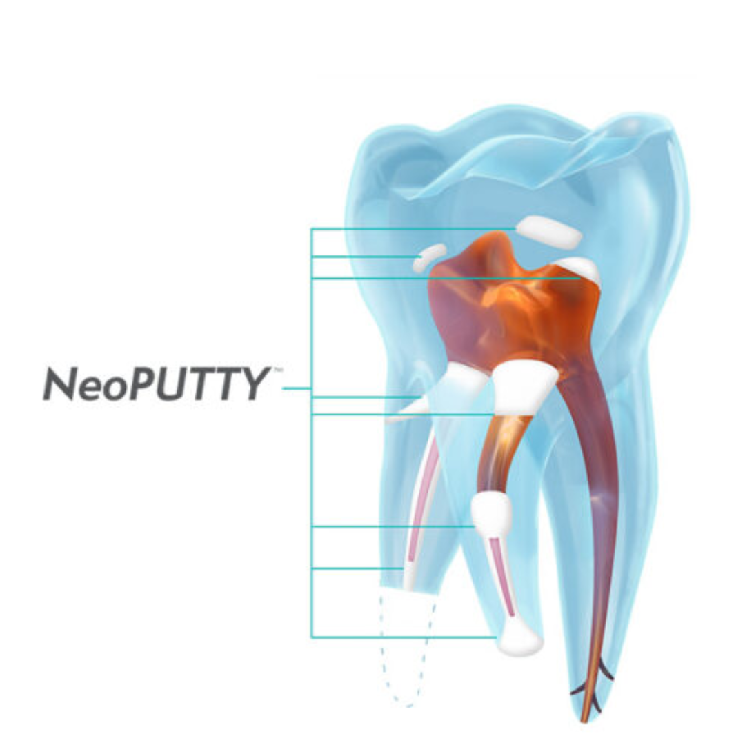 1 - NeoPUTTY®-1