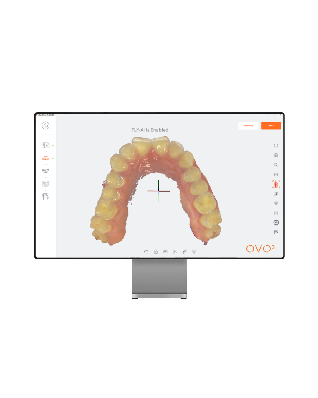 Scanner OVO3 3Disc – Scanner dentaire CAO/FAO haute précision-1